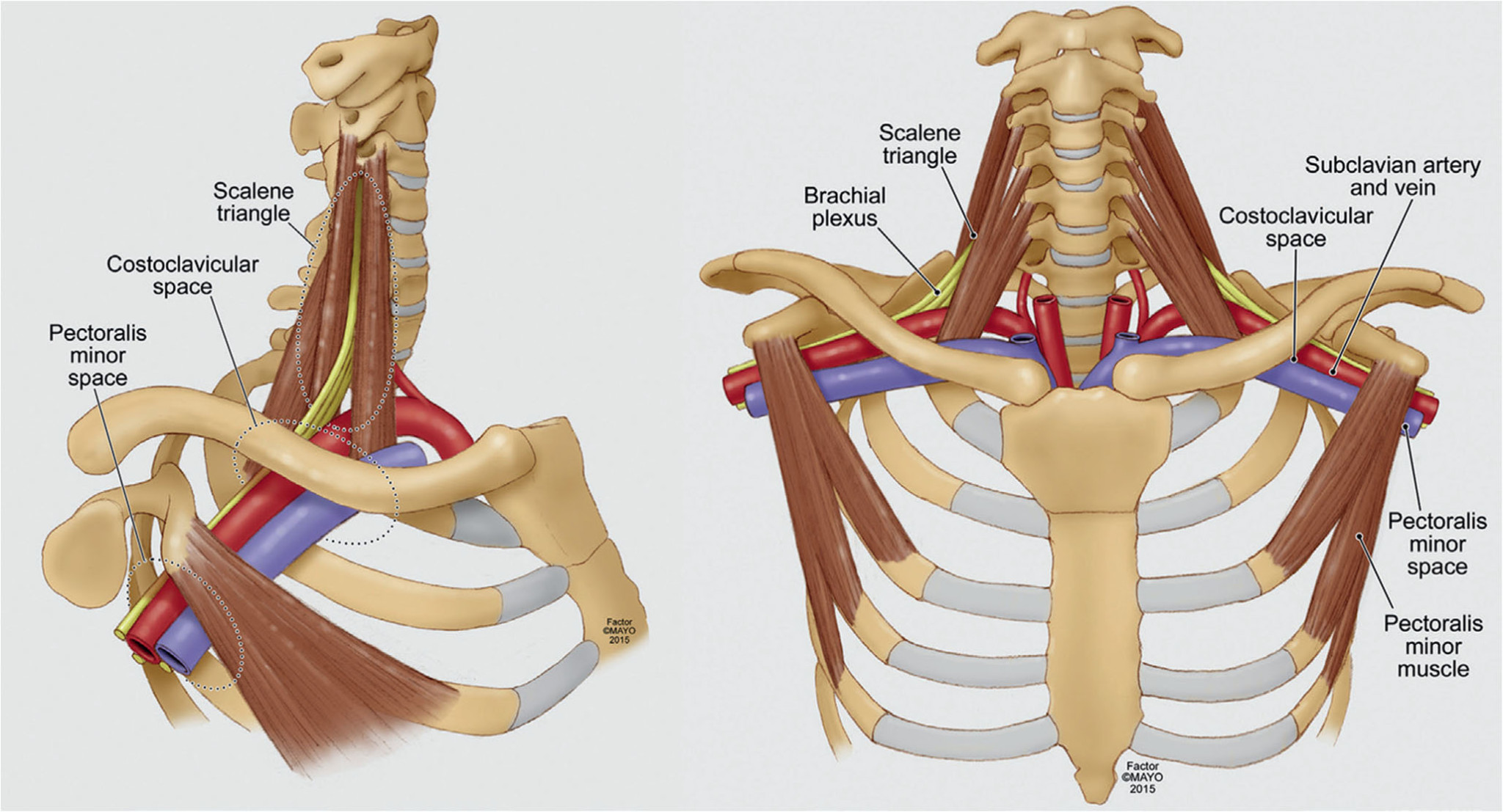 thoracic-outlet-syndrome-pm-r-knowledgenow